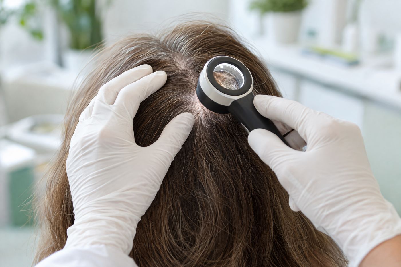 Esame del cuoio capelluto con il dermatoscopio
